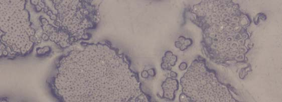 Figura 1. Micrografia ottica della sezione trasversale di alcune fibre di Phormium tenax Nonostante i vantaggi offerti da tali fibre, l'applicazione a fini semi-strutturali (p.es.