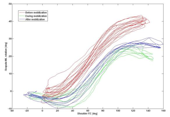 Dispositivo per la ricerca: Shoulder Meter Applicazione avanzata della tecnologia indossabile basata su