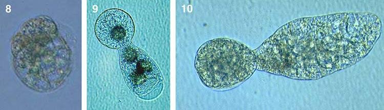 divisione asimmetrica dello zigote prodotto in vitro Fusione tra cellula spermatica e