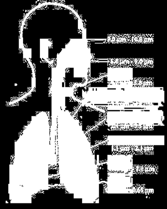 Il particolato che si deposita nel tratto superiore dell apparato respiratorio (cavità nasali, faringe e laringe) può generare vari effetti irritativi come l infiammazione e