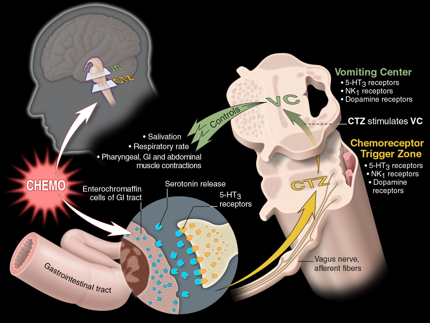 Pathophysiologyof