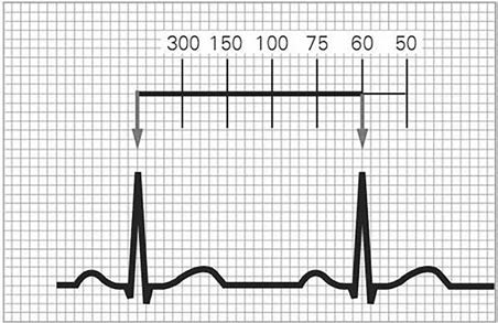 Frequenza Età media Range (battiti/min) Neonato 145 90-180 Lattante 140 106-185 1 anno 130 105-170 2 anni 120 90-150 4 anni 108 72-135 6 anni 100 65-135 10 anni 90 65-130 14 anni 85 60-120 TABELLA 2.