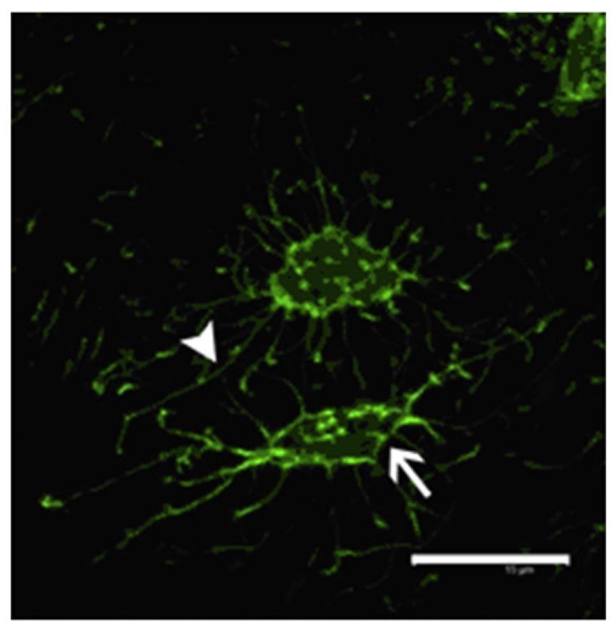 OSTEOCITI Klein-Nulend et al, Bone 2013 Immagine in immunofluorescenza del citoscheletro di osteociti nel topo.