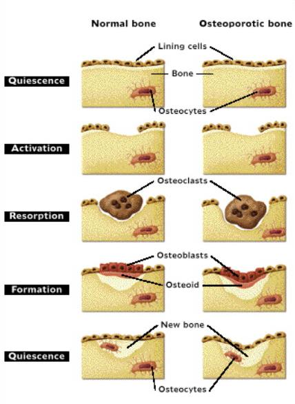 RIMODELLAMENTO OSSEO Osso normale Osso osteoporotico Il 90% della superficie dell osso è quiescente. Gli osteoclasti sono attirati dalla superficie dell osso esposta.