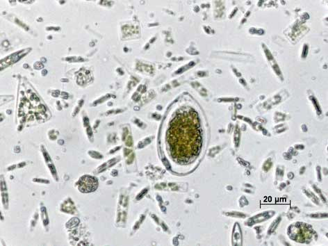 Ostreopsis ovata è un alga microscopica che vive principalmente negli ambienti costieri rocciosi.