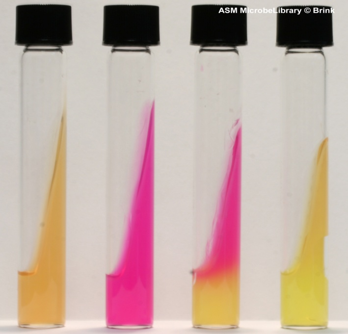 Appendice 2: Risultati dell Agar UreaUrea e Urea a becco di Clarino Adatti da Brink, B., 2013 2 Test del Ureasi FIG.