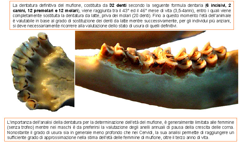 Dentatura