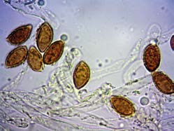 Lamelle smarginate, fitte, inizialmente biancastre, successivamente color bruno chiaro con sfumature rosate a maturità; filo chiaro (sterile) con segni di essudati essiccati (goccioline).