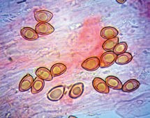 2012; exsiccatum conservato presso gli Autori. Cappello fino a 60 mm diametro, con umbone centrale screpolato, mammellonato, bruno scuro. Descrizione microscopica Spore 8-9.3 x 5.