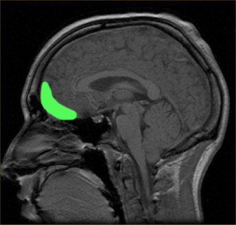 La neurobiologia evolutiva Il cervello si sviluppa e si organizza in funzione (e come riflesso) delle esperienze di sviluppo, organizzandosi in risposta ai pattern, intensità e qualità delle