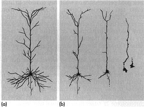 PERDITA DI NEURONI - La perdita di neuroni colinergici è responsabile per buona parte dei deficit di apprendimento e di memoria riscontrabili nella MA.