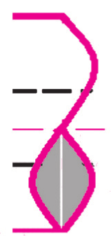 La rappresentazione grafica del polso singolo non ha una linea al centro.