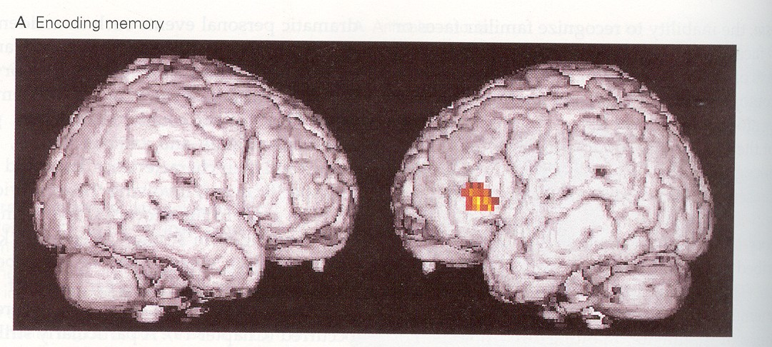 A-MEMORIA DI CODIFICA-corteccia prefrontale: tentativo di memorizzare parole a coppie per categoria