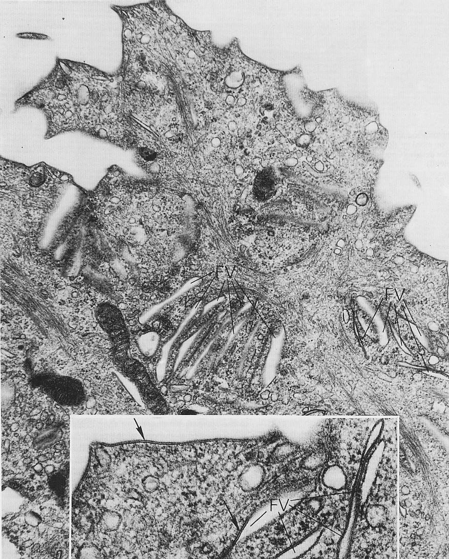 Epitelio di transizione IFs Filamenti intermedi particolarmente