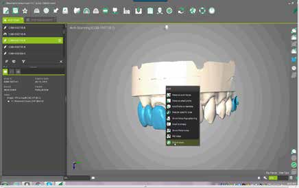 Sia in Dental Wings che in CARES Visual è possibile esportare l ordine una