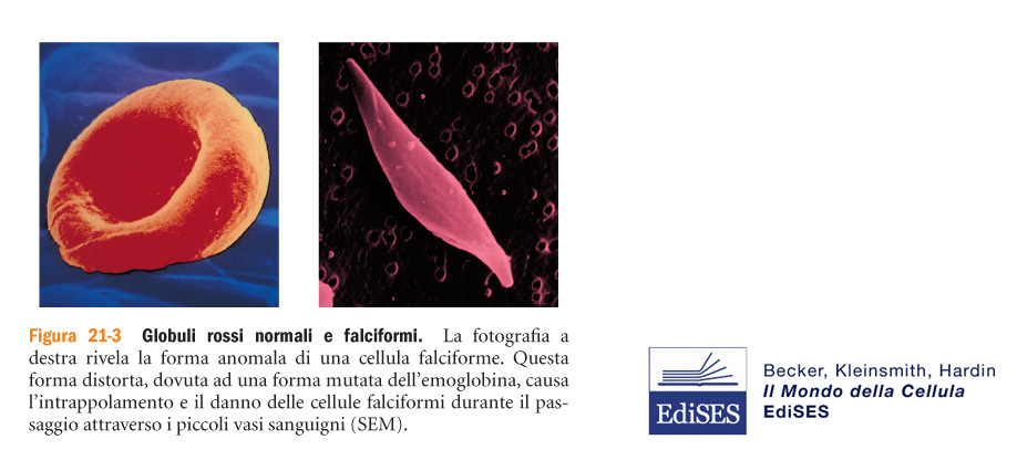 Pauling scoprì mediante l elettroforesi, che l emoglobina delle cellule falciformi migrava con una velocità