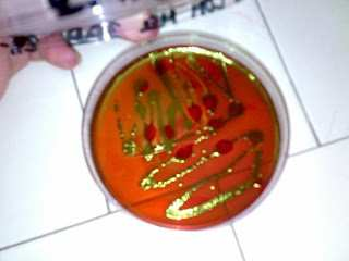 Identificazione: Fermentazione del lattosio La capacità di fermentare il lattosio è considerata una delle caratteristiche chiave per l identificazione degli Enterobatteri.