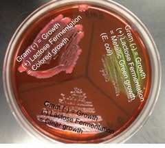 I coliformi producono colonie blu scuro mentre le colonie di Salmonella e Shigella sono incolori o assumono una colorazione ambra trasparente. Le colonie di E.