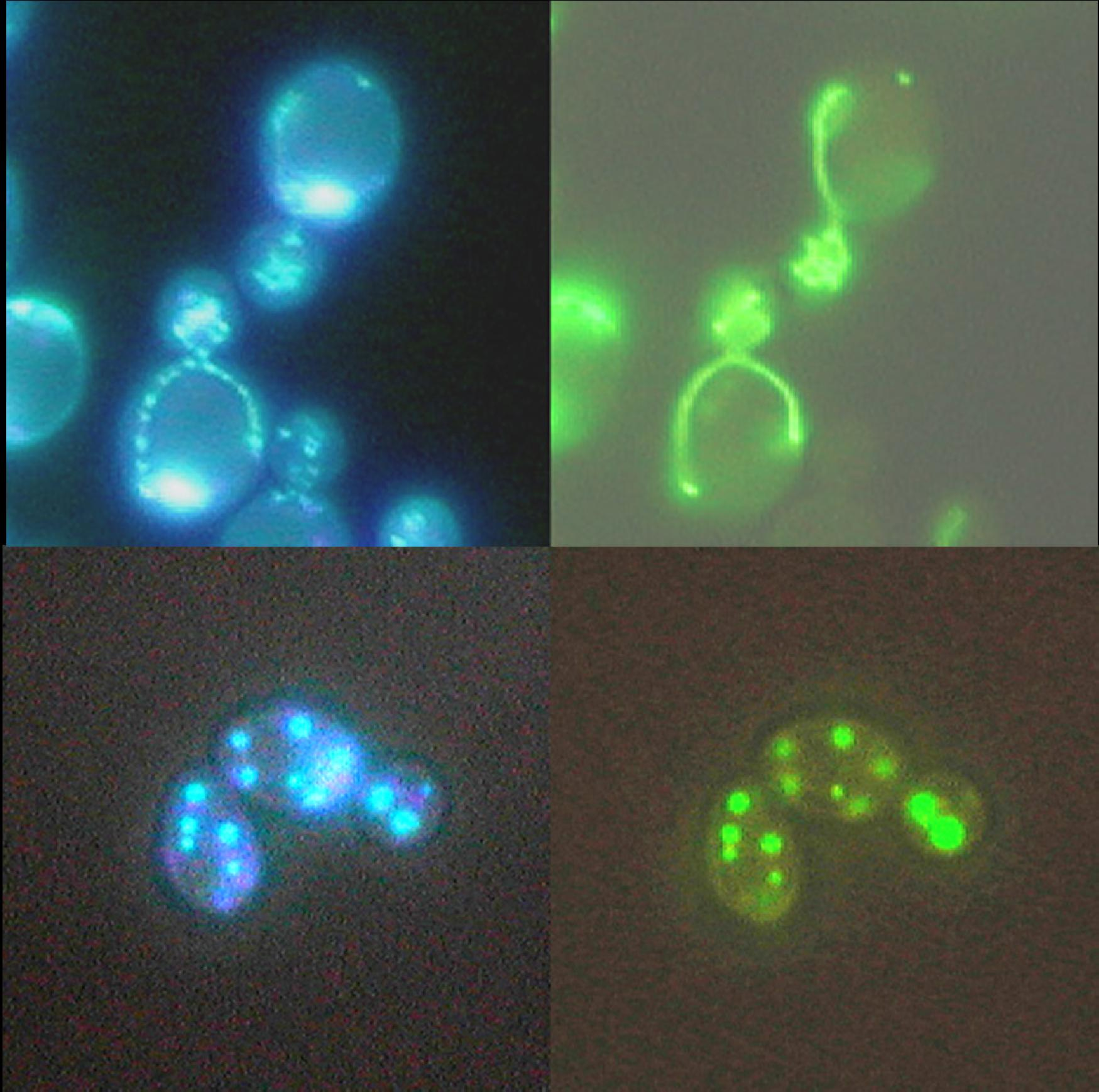 Microscopia di Fluorescenza The rpn11-m1