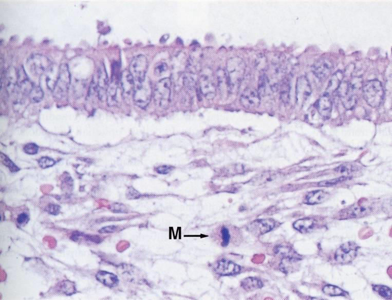 La mucosa uterina (endometrio) Epit.