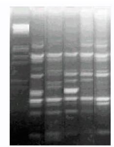 L uso dei marcatori molecolari consente di identificare le interazioni fra geni di reperire alleli favorevoli in specie selvatiche il successo della applicazione di queste tecnologie dipende dall