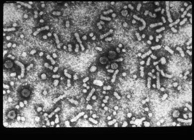 Virus dell epatite epatite B Hepadnavirus DNA a doppia elica