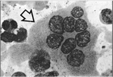 Osteoclasti Sono cellule di grosse dimensioni (20-100 microns) e plurinucleate Originano da cellule pluripotenti del midollo osseo, che sono anche