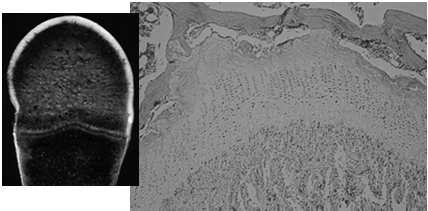 Cartilagine metafisaria Cartilagine metafisaria Zona delle cellule a