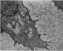 Condrocita Cellula metabolicamente molto attiva 2-10% del volume tessutale Capacità di risposta a diversi stimoli Responsabile del rinnovamento della matrice cartilaginea Cartilagine fibrosa Dischi