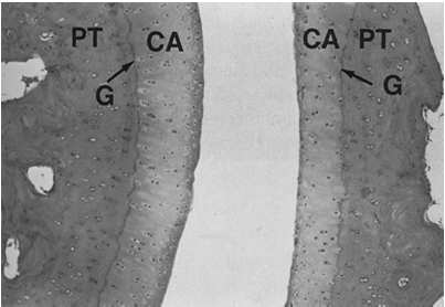 Articular