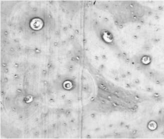 E attraversato nel senso della lunghezza dal canale di Havers, il cui calibro varia (20-110 microns) Le lamelle dell