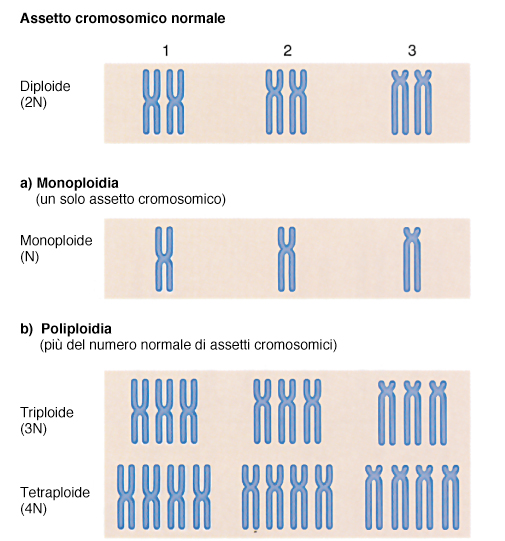 Fig. 10. Anomalie numeriche: le poliploidie. Nell uomo la presenza di una triploidia (Fig.