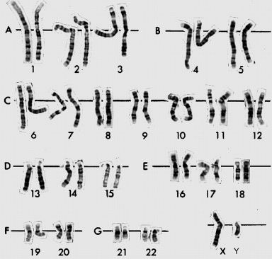 NB Ø la completa inattivazione di un segmento di cromosoma NON porta alterazione struttura genica Ø Le sequenze di geni repressi sono diverse da un tipo cellulare all altro e, a seconda del tipo