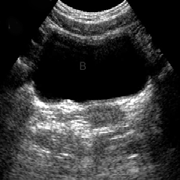 Urincoltura Antibiogramma Escludere