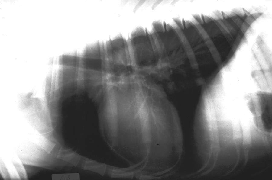 CUORE Radiologicamente ombra cardiaca proiezioni l-l, v-d, e d-v differenze di