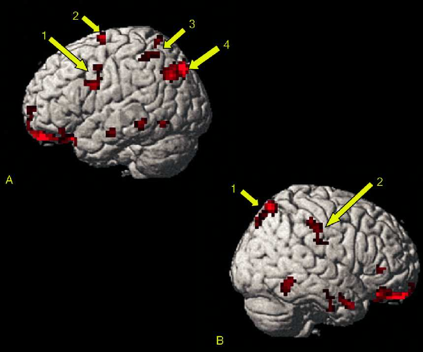 1. Corteccia premotoria ventrale 2. Corteccia premotoria dorsale 3.