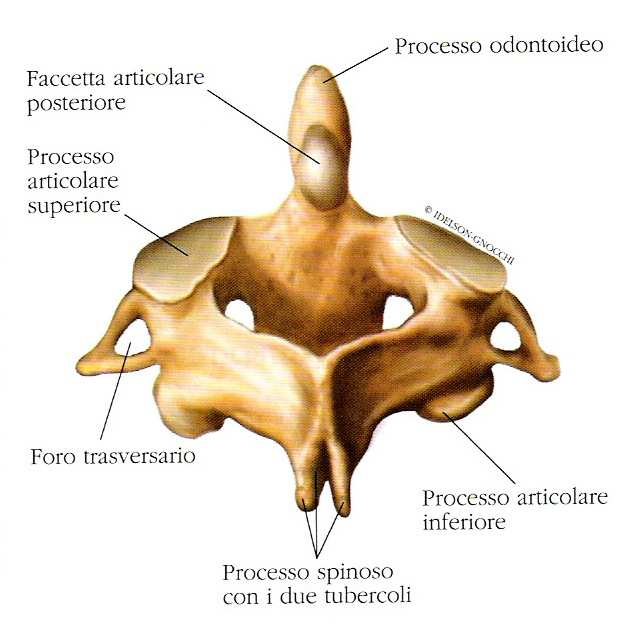 OSSA PIATTE: : hanno uno spessore molto ridotto e sono formate da due lamine di osso compatto tra cui è compreso uno strato di osso spugnoso (diploe( diploe) ) nelle cui trame è accolto il midollo