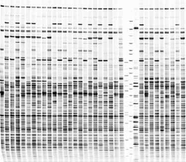 di DNA praticamente identiche, ugualmente identici saranno i siti di restrizione, e alla elettroforesi forniranno profili di migrazione sovrapponibili Le varie tecniche generano un fingerprinting