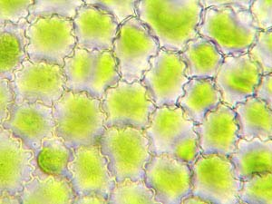 Al microscopio, le spore appaiono dotate di quattro braccia filamentose (figura 24). Alitando su di esse, i filamenti si contrarranno (figura 25).