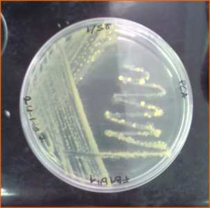 Batteri antagonisti Sono microrganismi che hanno mostrato di essere in grado di limitare o bloccare completamente lo sviluppo dei batteri fitopatogeni.