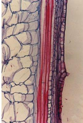 Comprendono fibrotracheidi e fibre libriformi con parete molto ispessita -