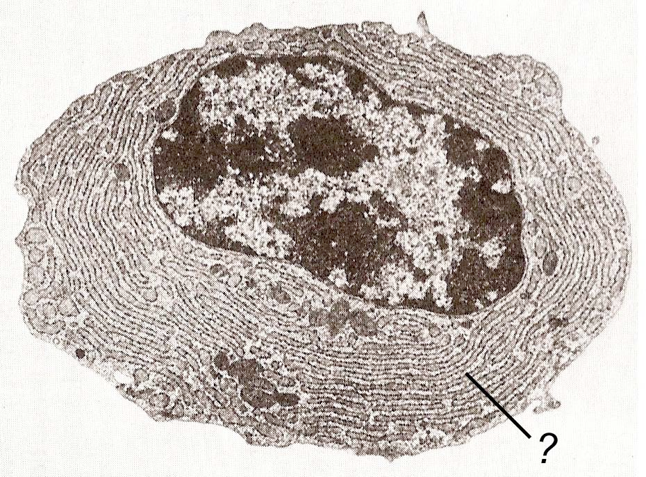 1) [10 punti] Ecco una plasmacellula: un tipo di globulo bianco specializzato nella sintesi di particolari proteine chiamate anticorpi: a) Indichi direttamente sul disegno almeno 5 organelli o