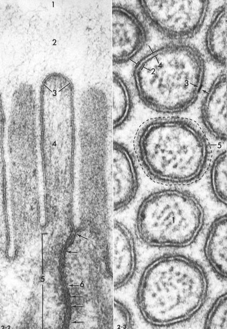 Microvilli Microvilli ISTOLOGIA In sezione