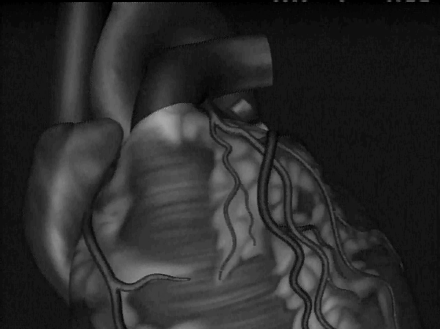 sistema a spinta idraulica con sorgente 90 Sr/ 90 Y Transfer Device contiene il treno di sorgenti catetere guida la sorgente Lunghezza del treno di sorgenti β Radionuclide Strontium - 90 attività