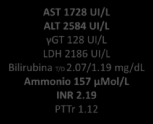 3.08 mg/dl AST 1728 UI/L ALT 2584 UI/L γgt 128 UI/L LDH 2186
