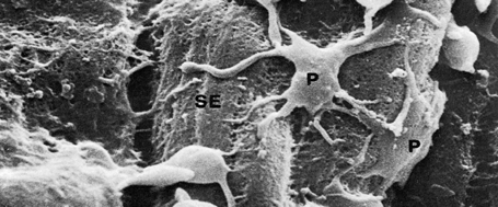 I FASE Una interruzione della continuità della parete