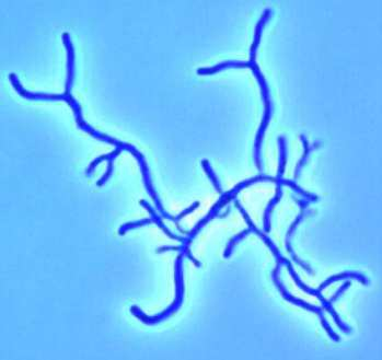 Il genoma di Bifidobacterium longum NCC2705 riflette il suo adattamento all ospite Il suo genoma contiene un elevato numero di proteine