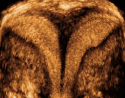 I recenti avanzamenti tecnologici (power Doppler, ecografia tridimensionale) hanno imposto questa metodica diagnostica in ogni campo della ginecologia, dalla infertilità alla oncologia.