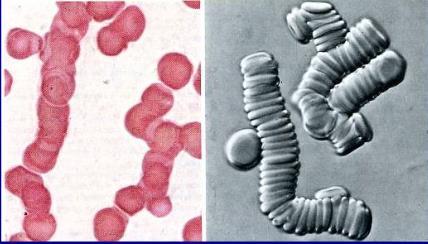 Agglutinazione eritrocitaria