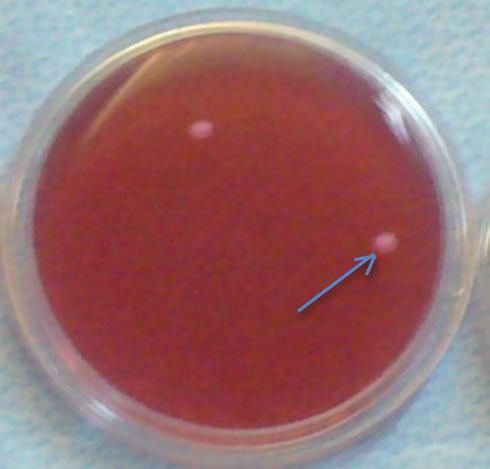 MAC CONKEY AGAR: contiene sali biliari e cristal violetto come agenti selettivi, lattosio ed un indicatore di ph, il rosso neutro, come agenti differenziali.